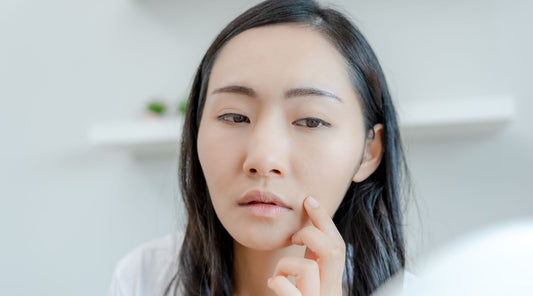 Effective Treatments for Pimples on Sensitive Skin