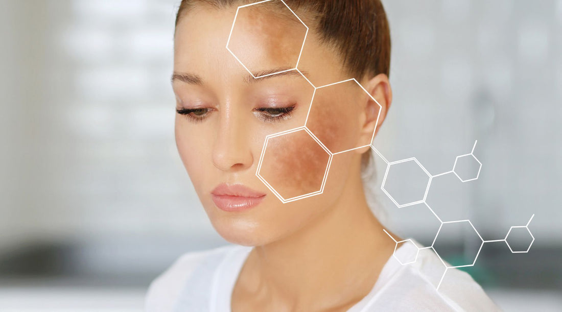 Understanding the Causes of Black Spots on the Face: Top 10 Factors Explained