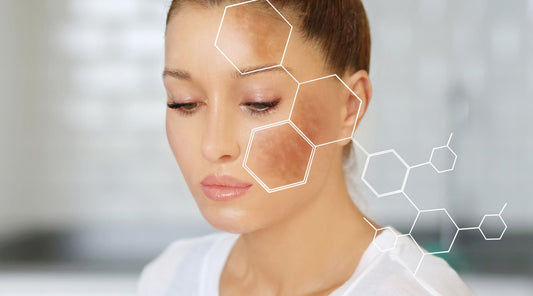 Understanding the Causes of Black Spots on the Face: Top 10 Factors Explained