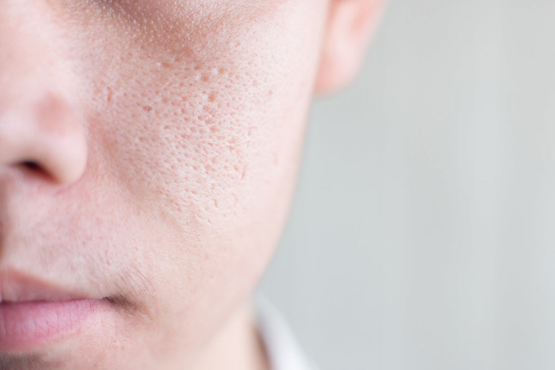 The Truth About Pores: Can You Really Shrink Them?