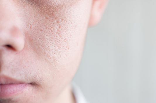 The Truth About Pores: Can You Really Shrink Them?