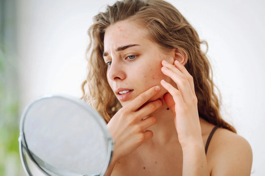 Tired of Breakouts? Here’s What Dermatologists Really Recommend