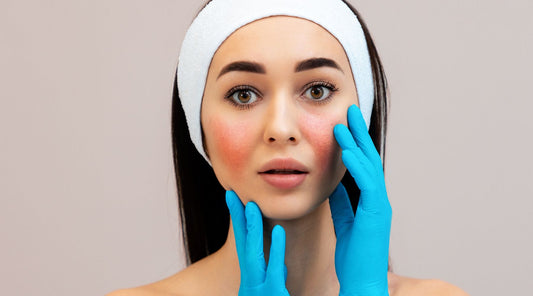 Treat Sensitive Skin: The Power of Ceramide Serum