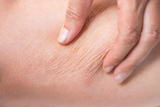 Dry, Dull, or Dehydrated? How to Know—and Fix It Fast