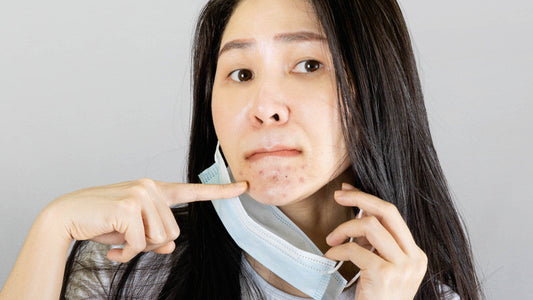 How to Deal with Maskne and Other Skin Concerns from Wearing Masks