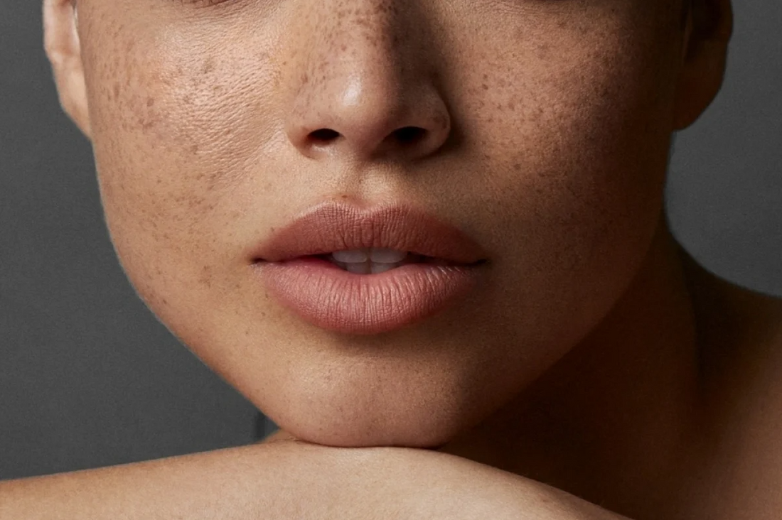 Why Skin Barrier Repair Is the Key to Glowing Skin