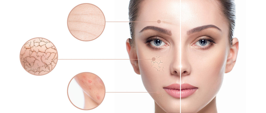 🌟 From Dull to Radiant: Revamping Your Skincare Routine This January 🌟