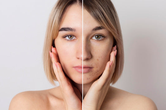 Dark spots on the face: Causes and Treatments