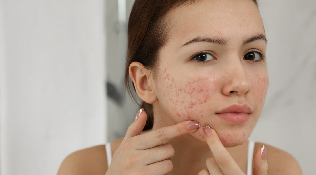 8 Effective Ways to Solve Skin Irritation