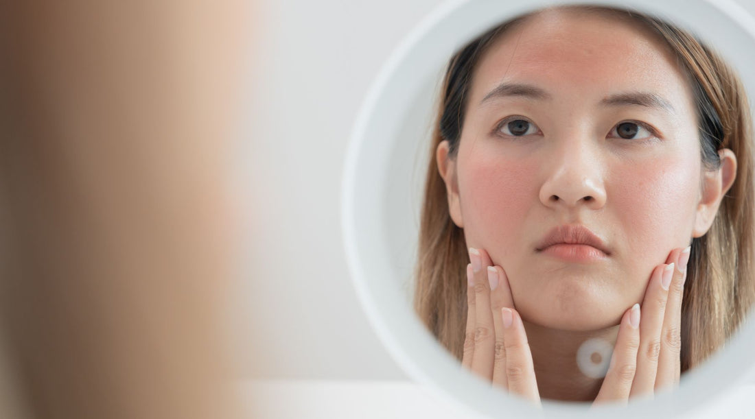 Understanding Redness and Sensitive Skin: Causes, Tips, and Solutions