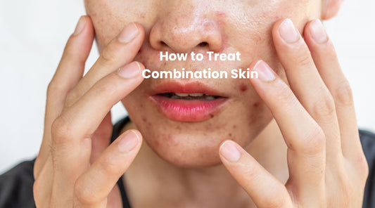 How to Treat Combination Skin