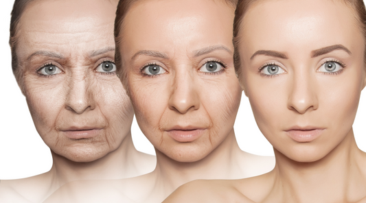 5 Reasons That Cause Premature Aging of the Skin