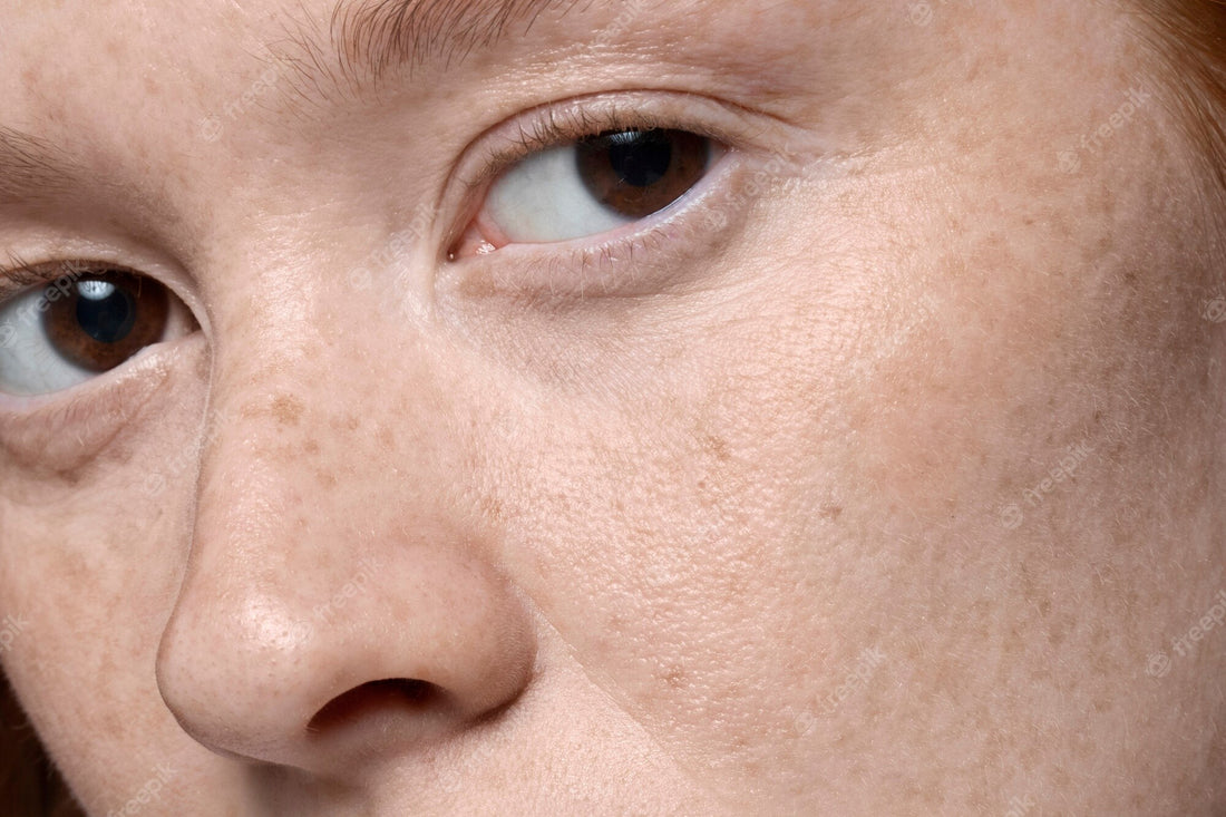 How to Minimize Your Pores with 8 Ways