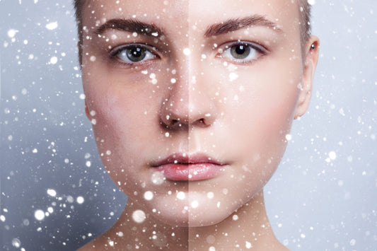 Winter Skin Woes: How to Combat Redness, Dryness, and Irritation ❄️💧