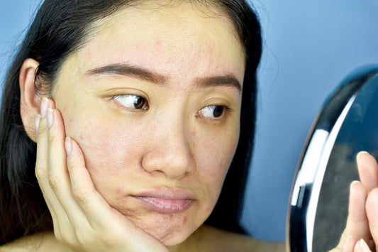 Why Your Skin Looks Dull in Summer (And How to Bring Back Its Glow)