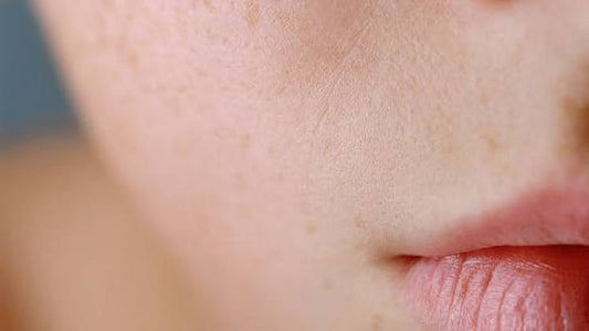 What Causes Dehydrated Skin? Here's How to Tell the Difference