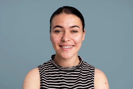 From Summer to Cooler Days: How to Protect Your Skin Barrier